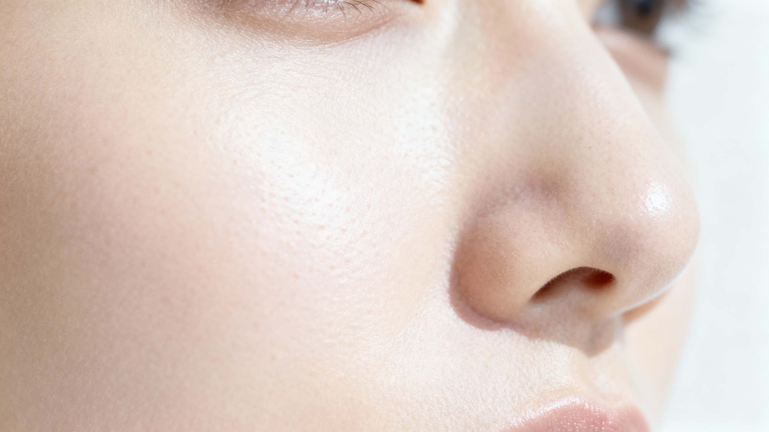 Featured image for Being On Top of Acne Scarring